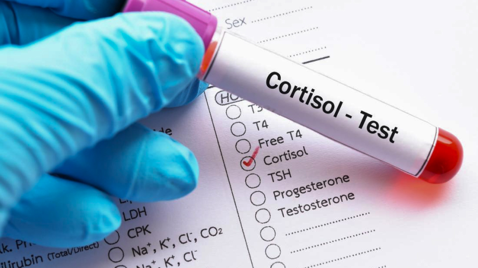 Why Should You Monitor Cortisol Levels